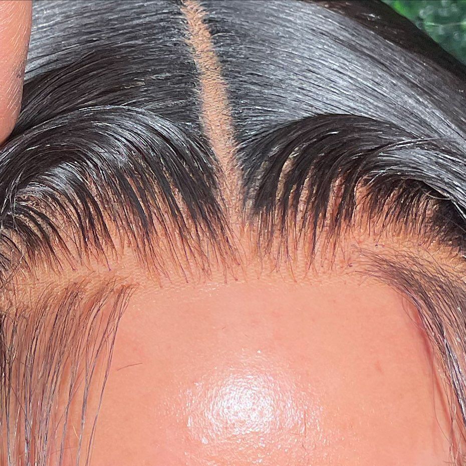 Elite Cranial Solutions with Prescription